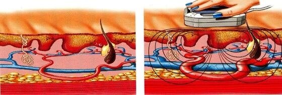 si tes jambes s'engourdissent