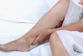 Causes et symptômes des varices dans les jambes.