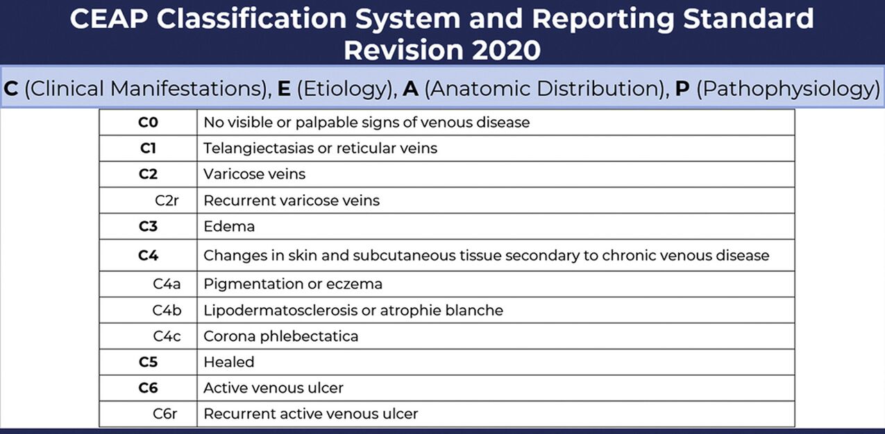 Stades des varices selon la classification CEAP avec modifications de 2020